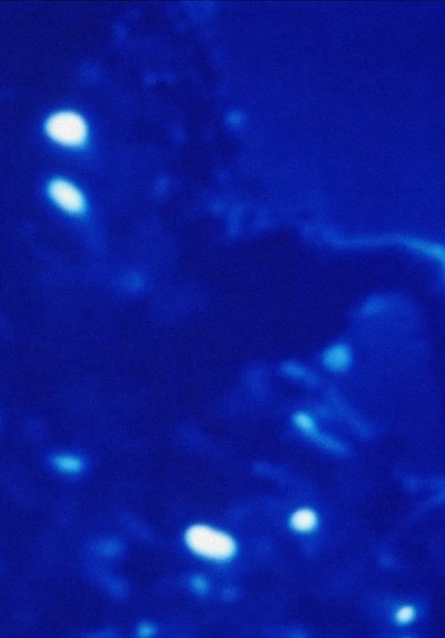 Morfología de un sueño